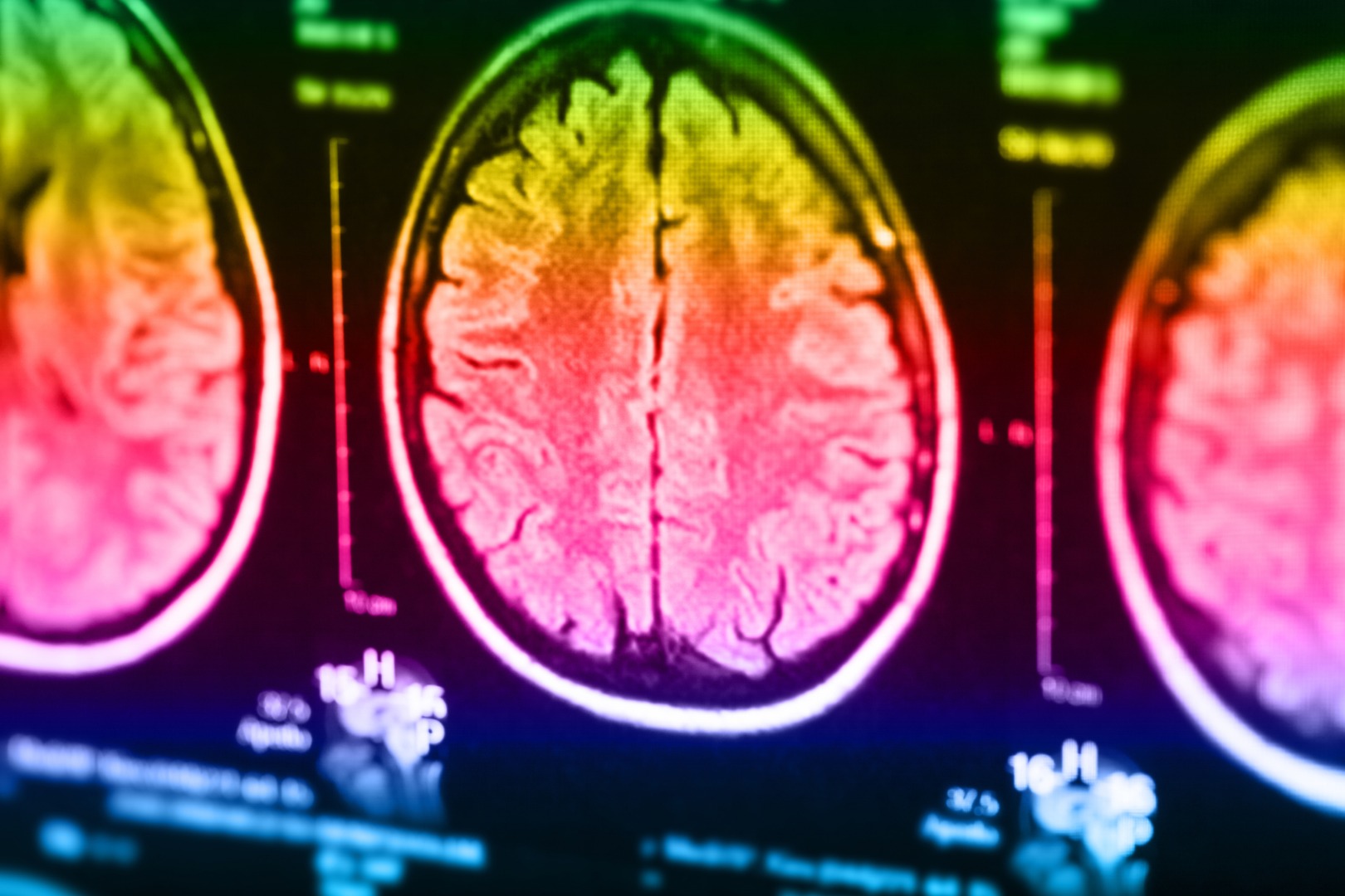 Marine Study Examines Stress Brain >> Inside The Head Of A Killer Imaging Study Uncovers Unique Marine Study Examines Stress Brain >> Inside The Head Of A Killer Imaging Study Uncovers Unique