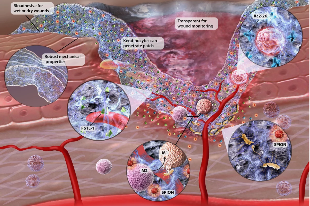 A diagram of the dressing, which is not yet available for clinical use