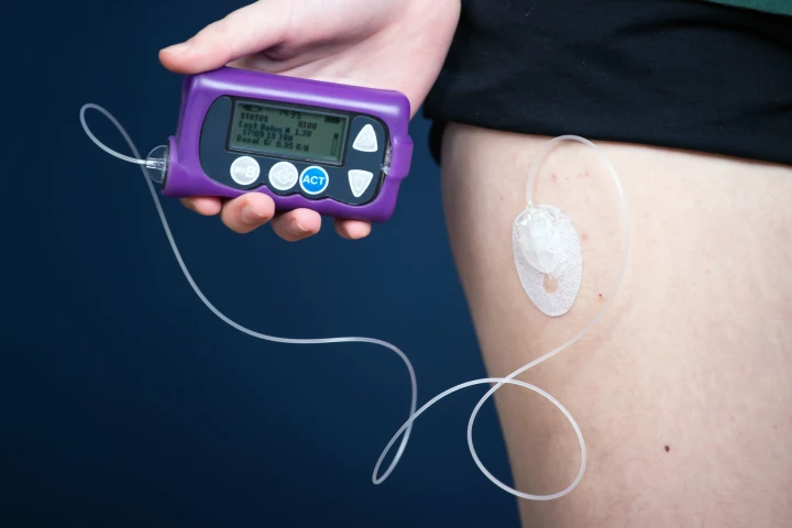 An old drug may be repurposed to modify the course of type 1 diabetes after diagnosis