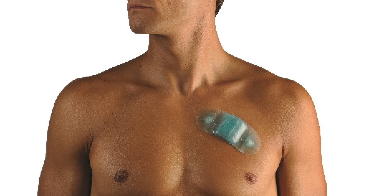 Small adhesive patch outperforms traditional tech for detecting arrhythmia