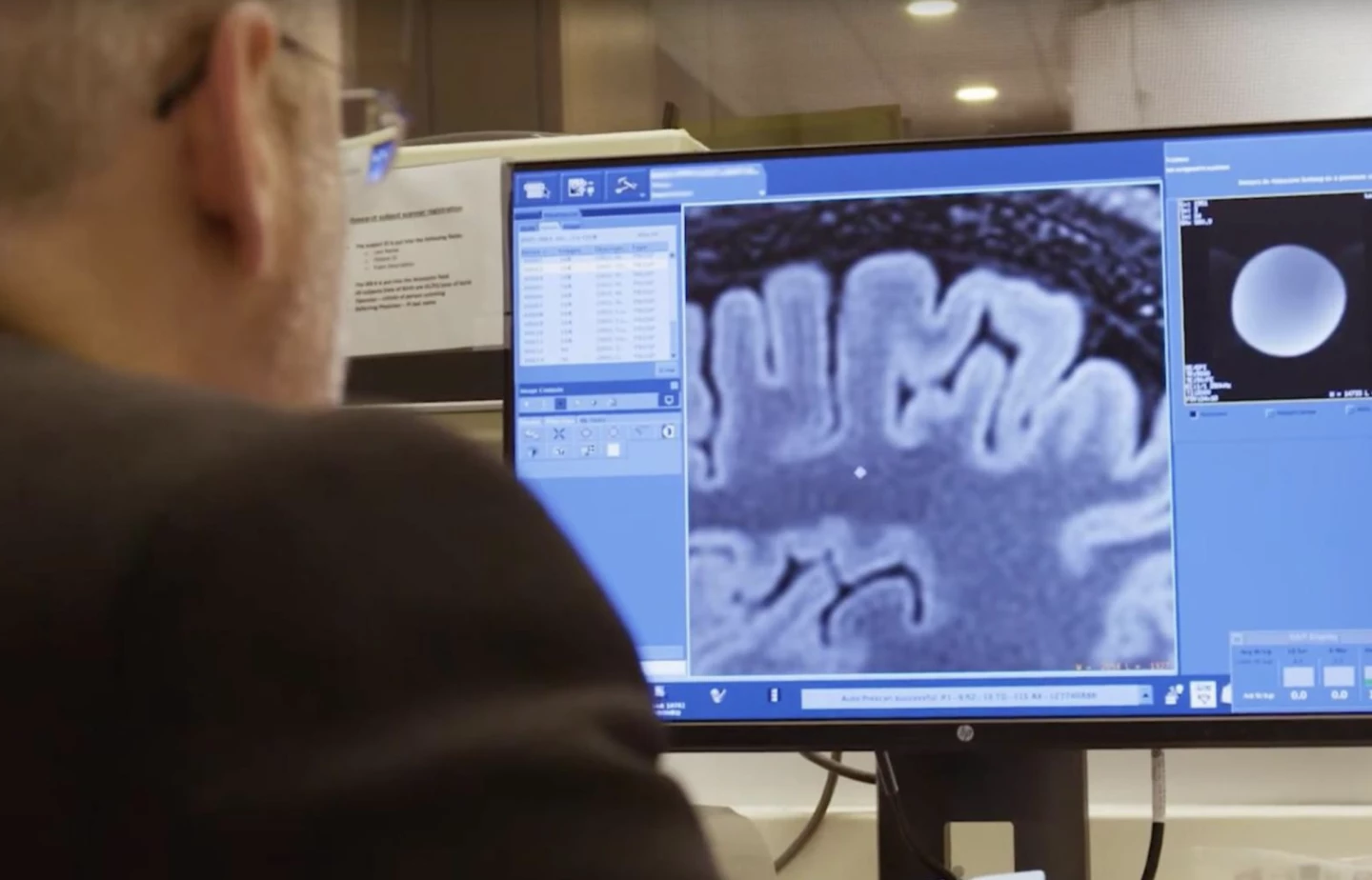 Two new dMRI methods reveal more about the impact of soccer heading than previously known