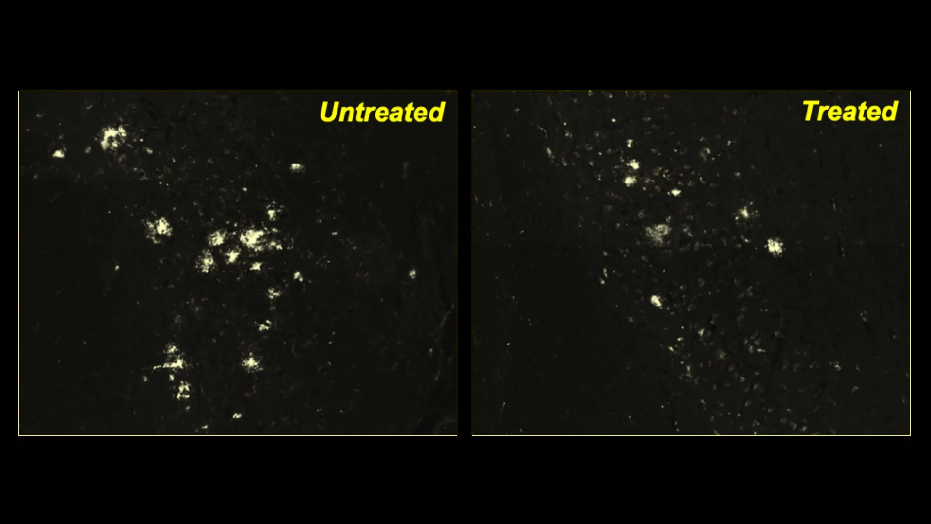 Fewer protein clumps can be see in mice treated with a novel drug to boost cellular cleaning