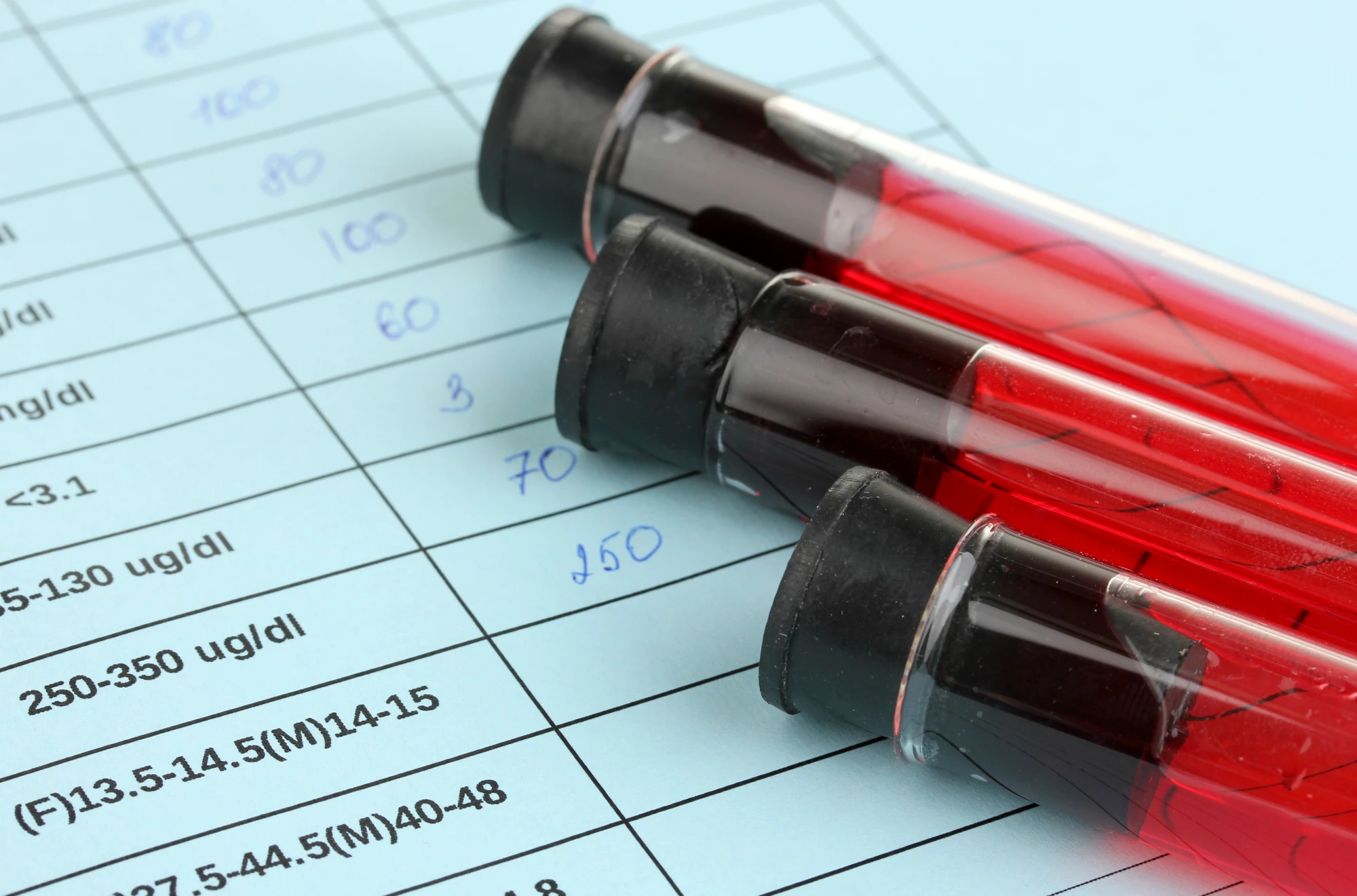 A blood test can detect DNA fragments from brain tumors circulating in a patient's bloodstream