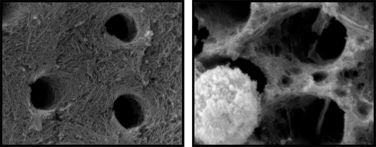 After being exposed to neutrophils for 24 hours, collagen was found to develop cavities