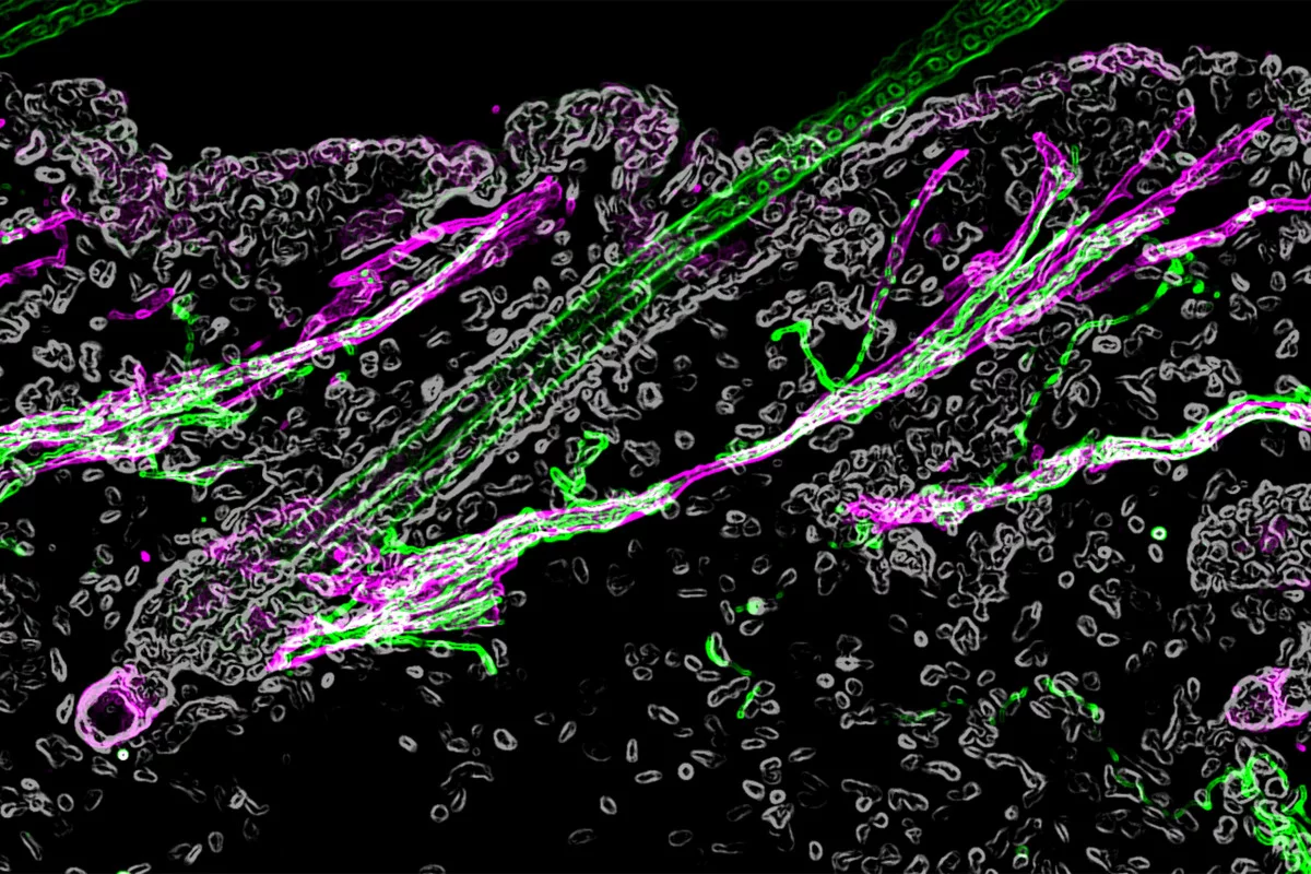 A microscope image of the hair follicle – the sympathetic nerve is in green, while the muscle is magenta