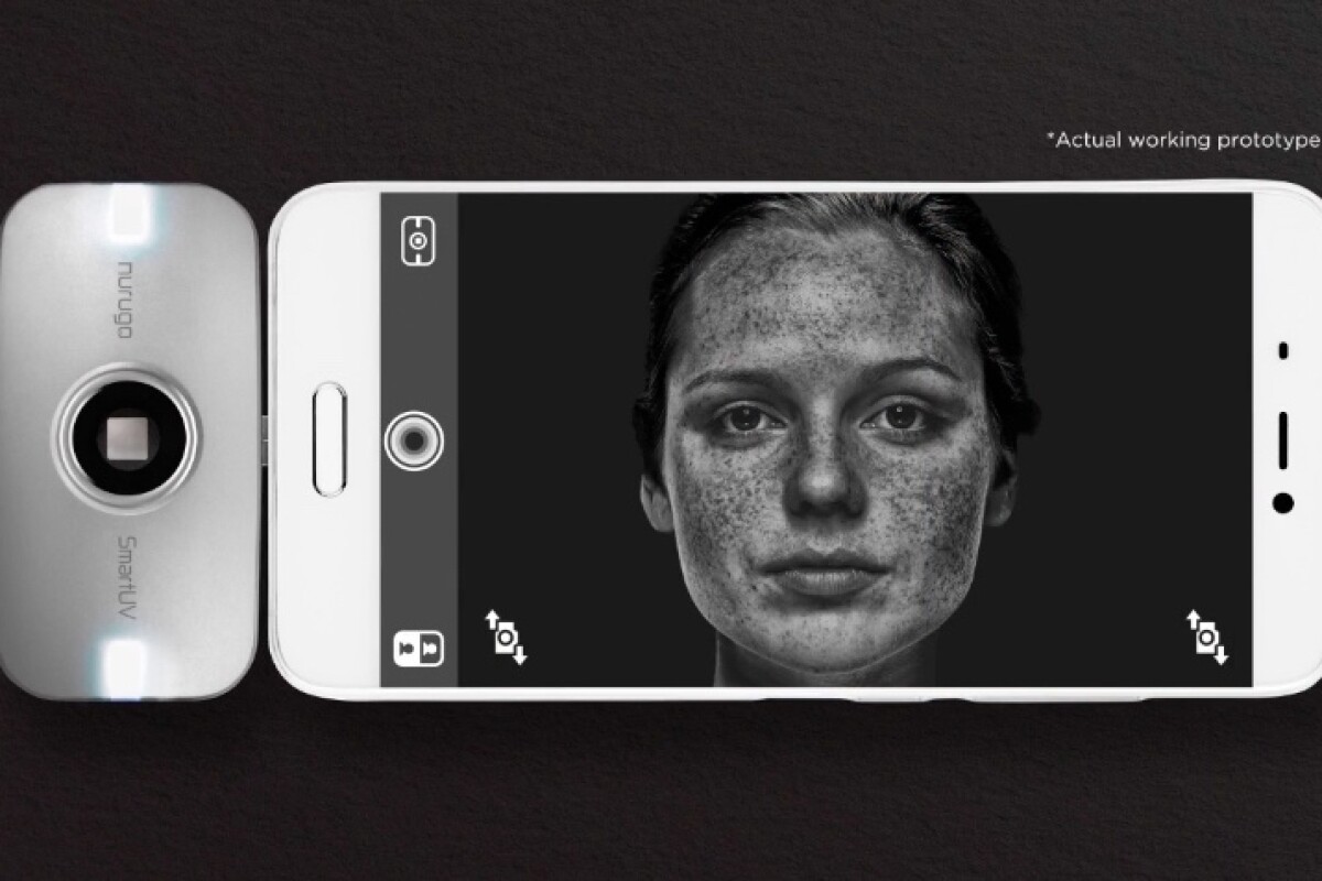 Smartphone addon sees into your skin