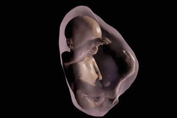 A 3D virtual model MRI view of a fetus at 26 weeks