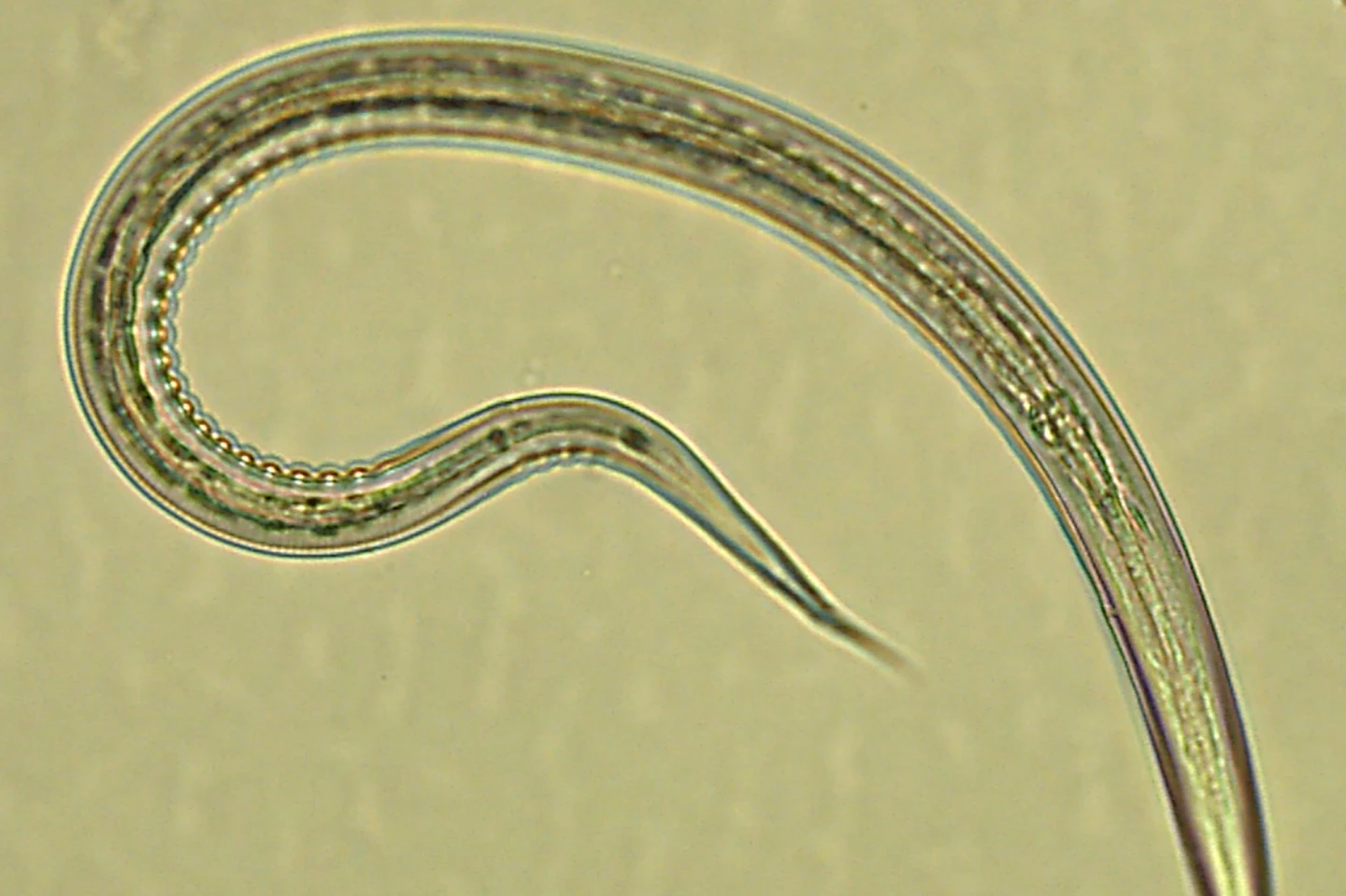 Hookworms were found to decrease insulin resistance (and study participants grew quite fond of them)