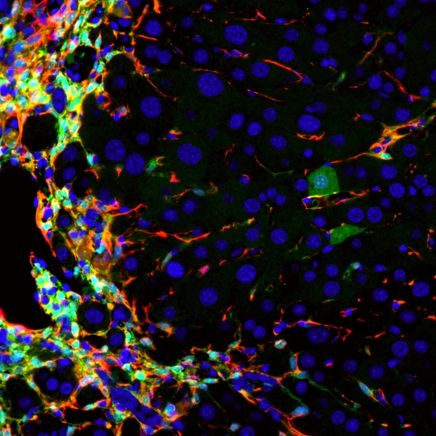 A section of mouse liver that shows liver disease in red being converted into healthy new liver cells in green