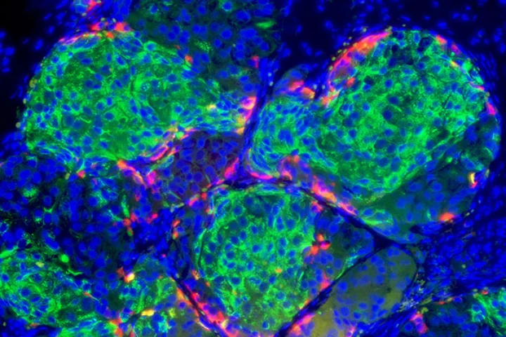 Human stem cell-derived beta cells formed islet-like clusters and made insulin when transplanted in mice, curing them of diabetes (Image: Doug Melton)