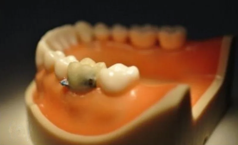 The sensor will allow doctors to keep tabs on patient's health habits