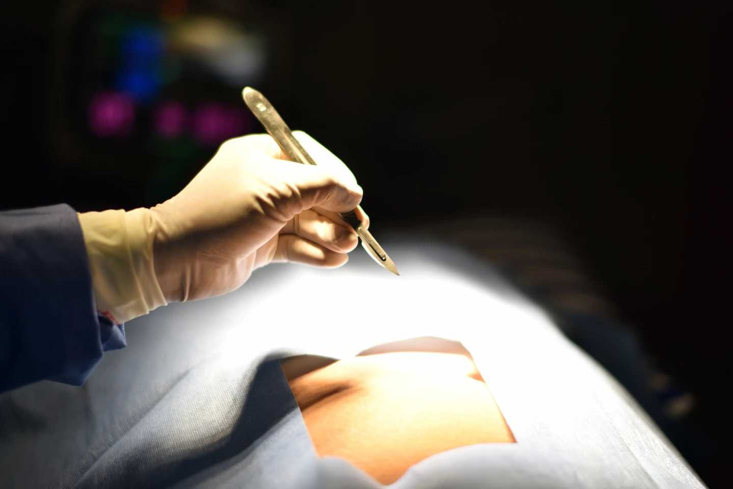 Alarmingly, compared to white patients, Black patients were 22% more likely to die in hospital after coronary bypass surgery