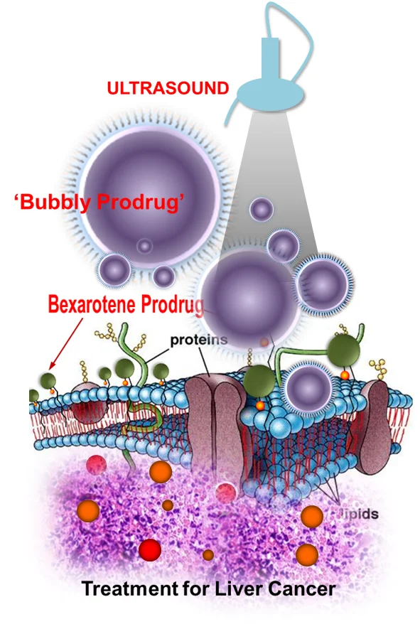 Exploding nanobubbles attack cancer cells from the inside out