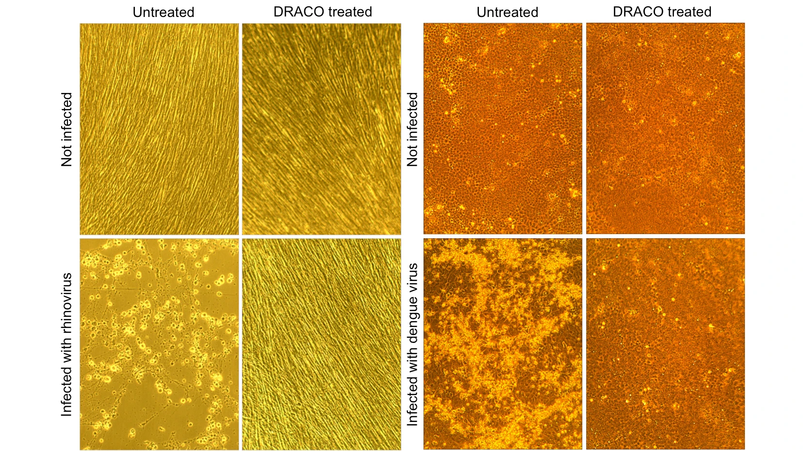 In this set of four photos, dengue hemorrhagic fever virus kills untreated monkey cells (lower left), whereas DRACO has no toxicity in uninfected cells (upper right) and cures an infected cell population (lower right) - (Image: MIT)