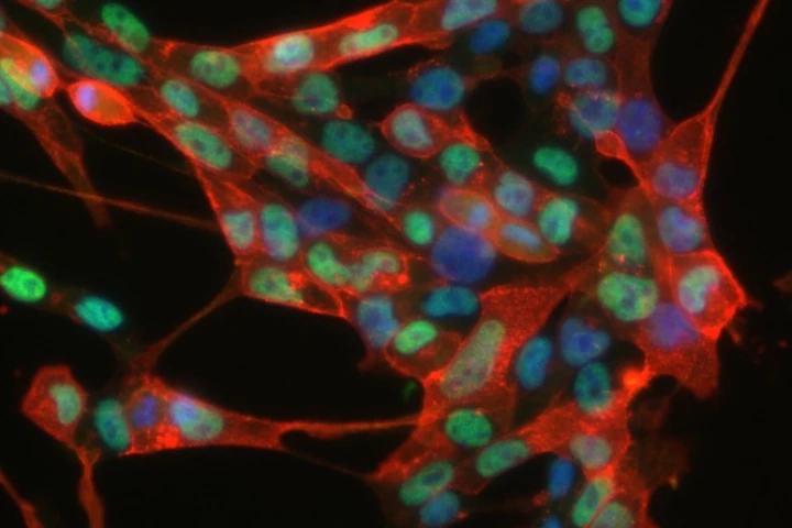 Image of the induced neural stem cells created by reprogramming skin cells (Photo: MPI for Molecular Biomedicine)
