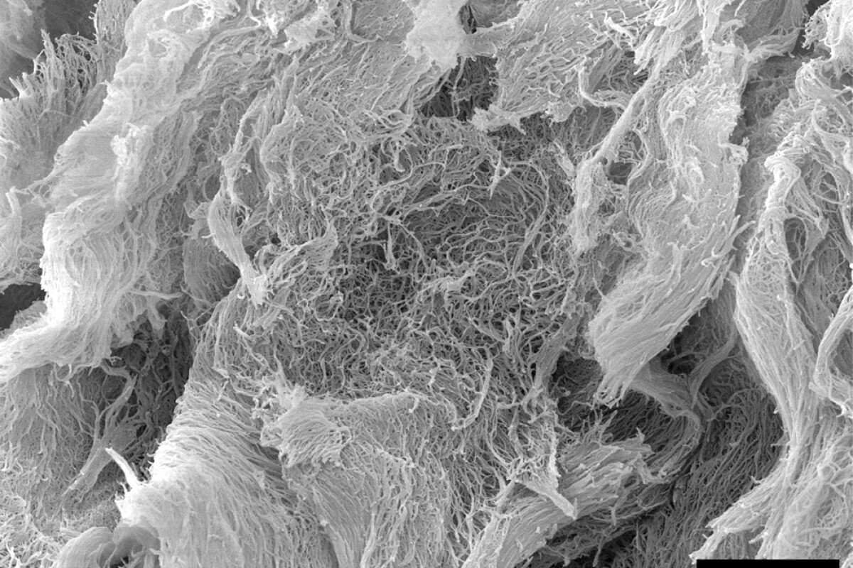 A scanning electron microscope image of the injectable cancer-fighting hydrogel, dubbed STINGel