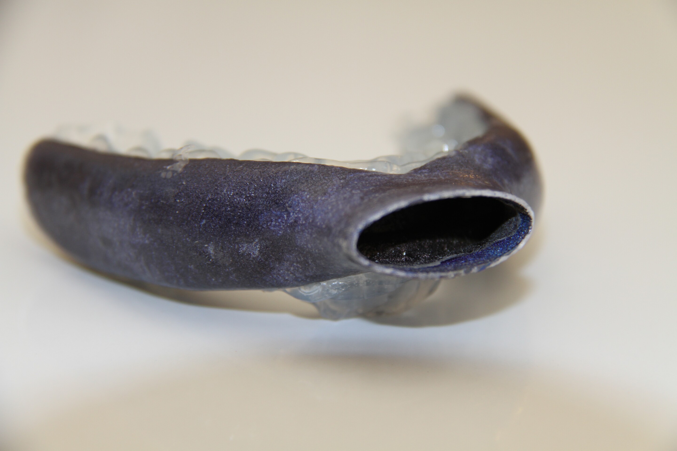 3Dprinted mouthpiece clears the air for sleep apnea sufferers