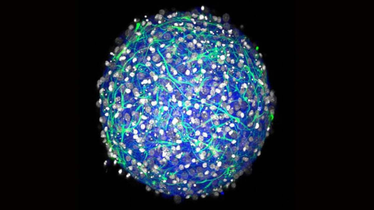 Lab-made mini-brains are sprouting their own blood vessels