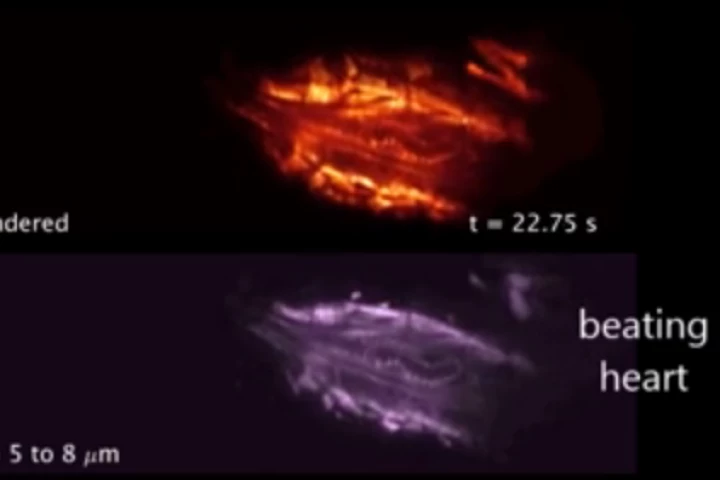 A new 3D microscope has been developed at Columbia University Medical Center that is able to capture detailed images of living things at very high speeds (Photo: CUMC)