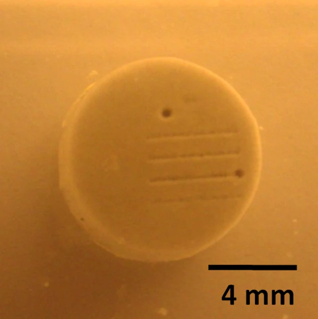 A confetti-sized artificial kidney stone, with a sub-150-micrometer hole bored into it using the focused sound beam