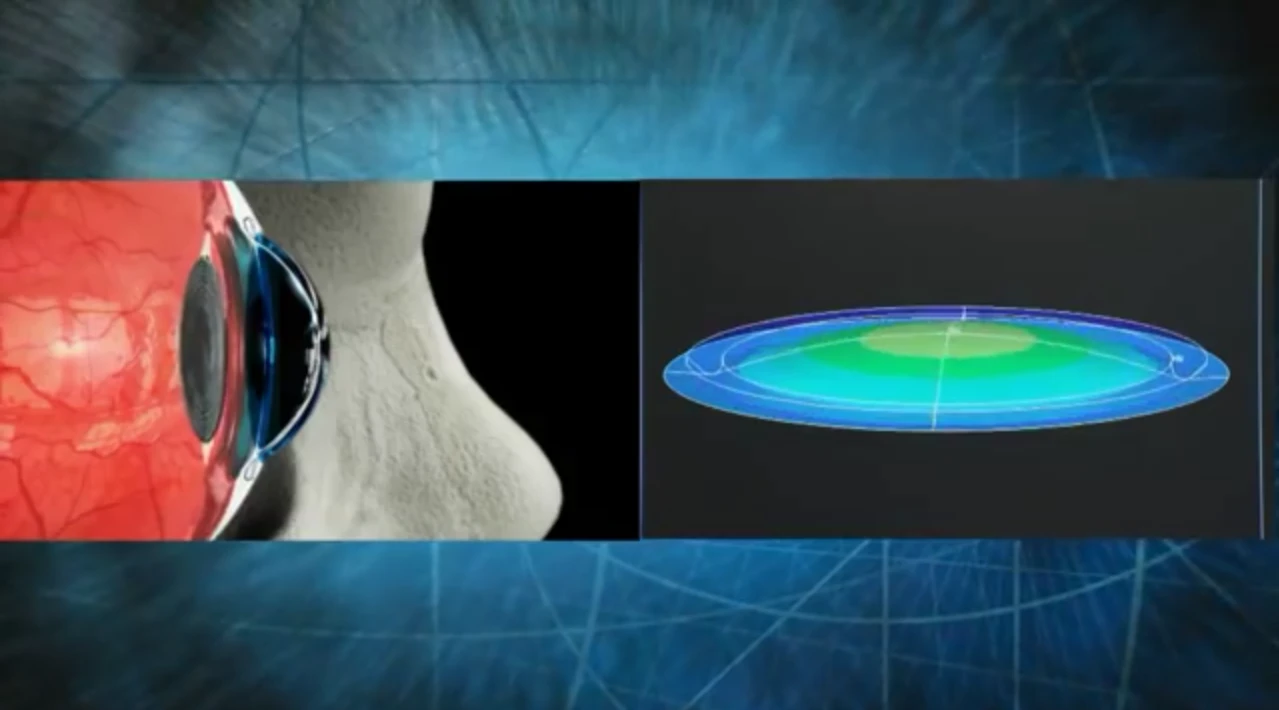 Human eye compared with the adaptive zoom polymer lens