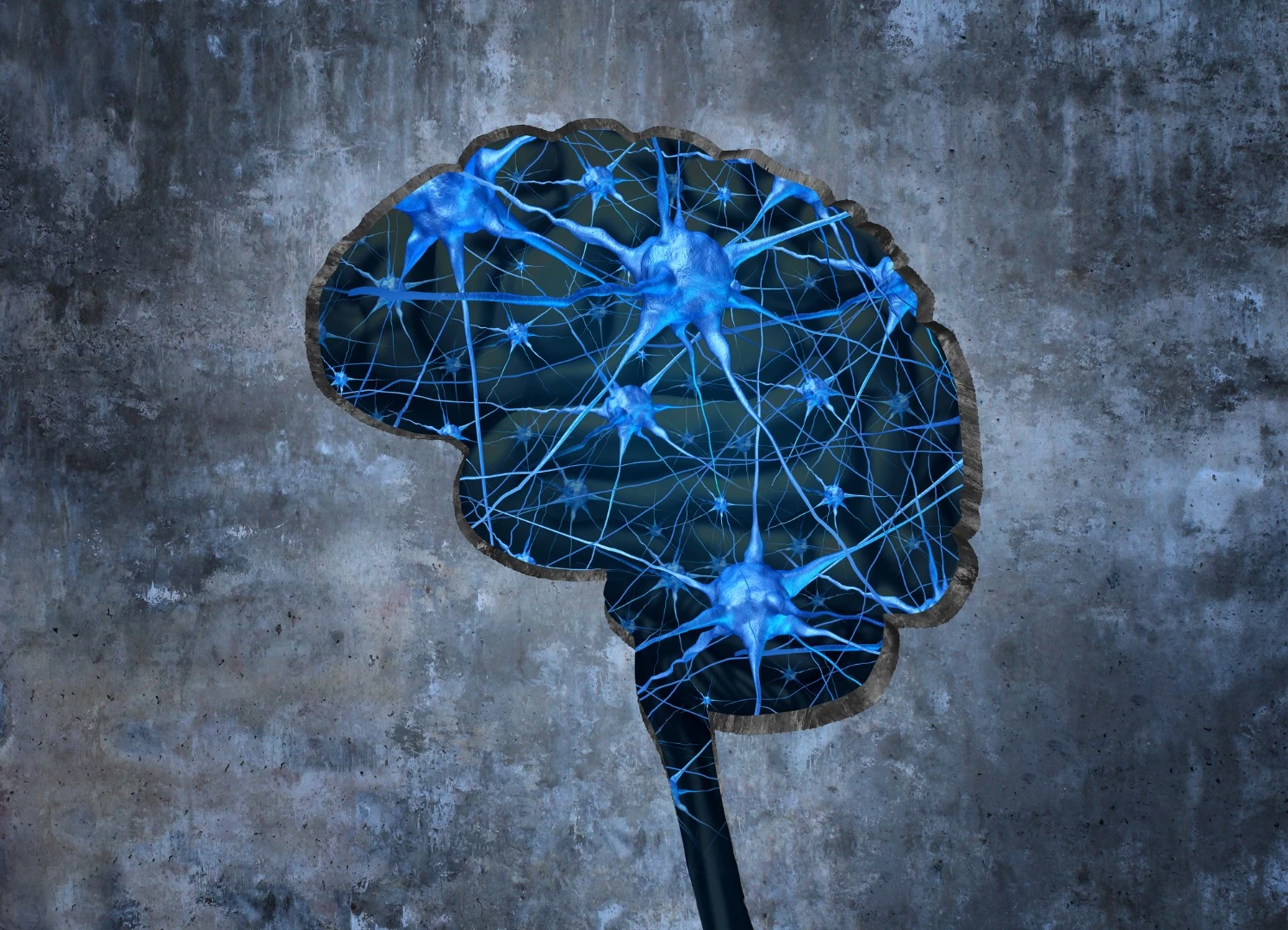 The discontinuation of more major human clinical trials again raises doubts over whether the current causal hypothesis for Alzheimer's disease is correct