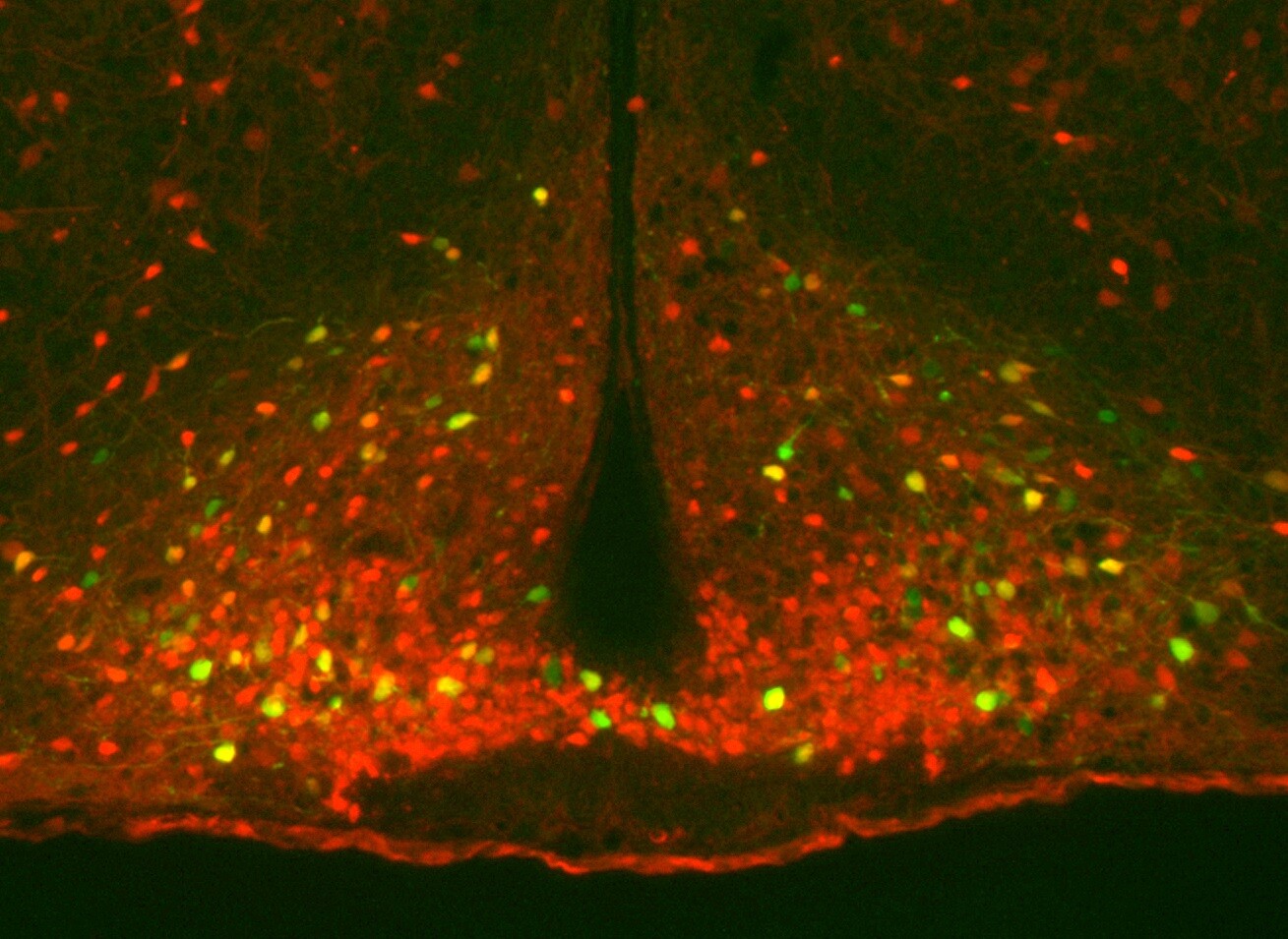 In a mouse study, important neurons that regulate metabolism (shown in green and yellow) were found to activate for up to two days after a single exercise workout