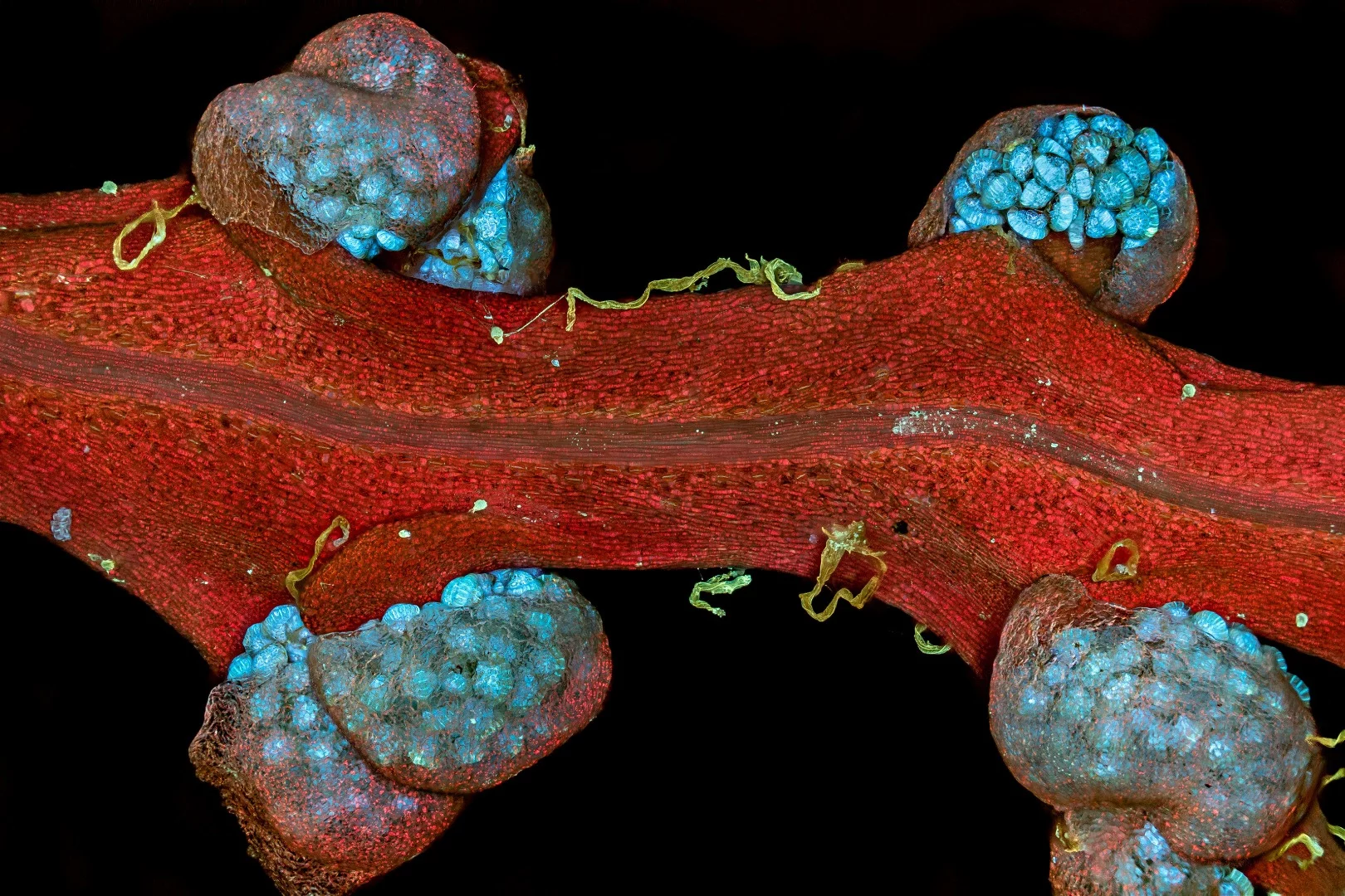 Image of Distinction: Fern sori (structures producing and containing spores)