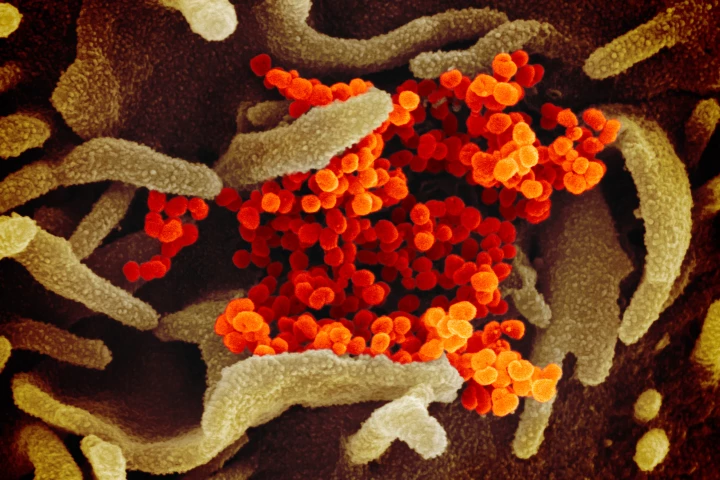 This scanning electron microscope image shows the novel coronavirus, SARS-CoV-2 (colored in orange), isolated from a patient in the U.S., emerging from the surface of cells (green) cultured in the lab