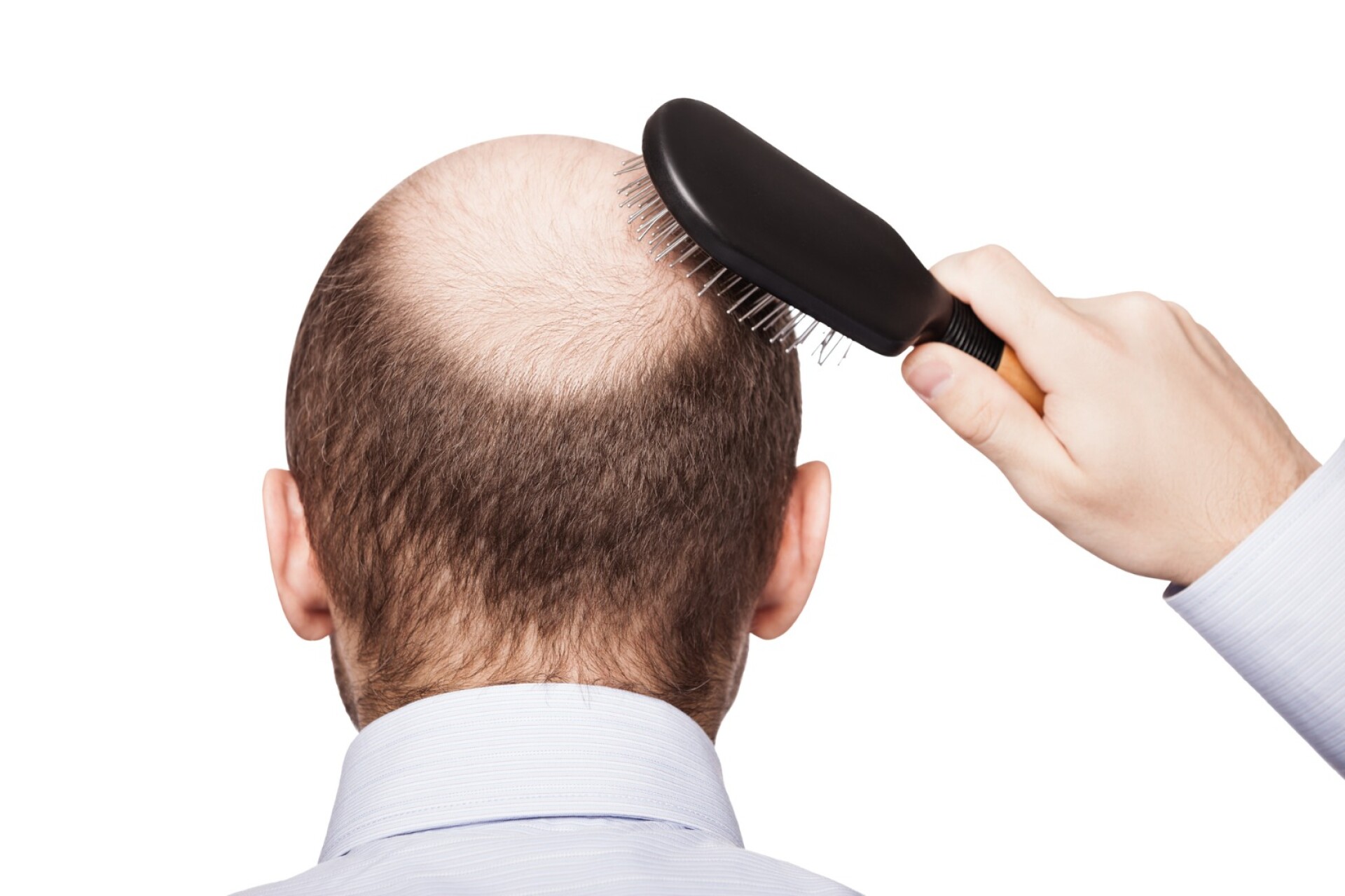 Side effect of an old drug inspires new hope for treating hair loss