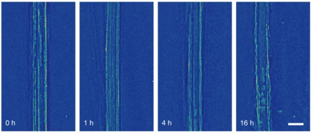 X-ray images of the anode show a smooth surface of lithium