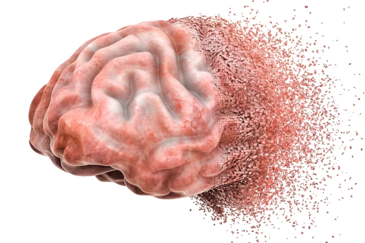 A new discovery could make it possible to diagnose dementia before it damages the brain, and identify what kind of dementia a person will ultimately suffer