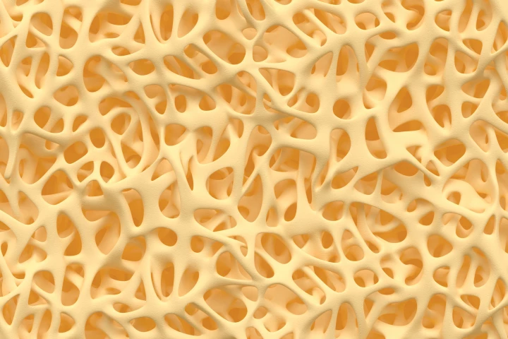 When exposed to harmless visible light, the hydrogel becomes a porous solid that promotes the growth of natural bone tissue (pictured)