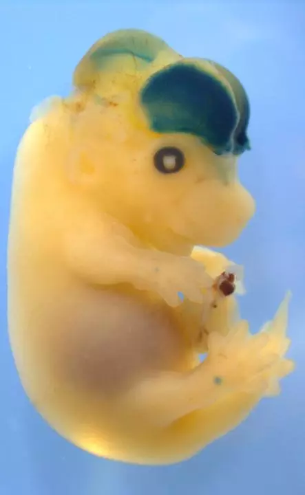 The mouse embryo developed a giant brain after being injected with the human version of a DNA sequence called HARE5 (Image: Silver lab, Duke University)