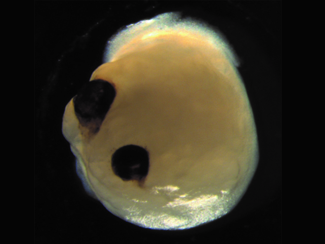 A brain organoid, with two optic cups that can detect light