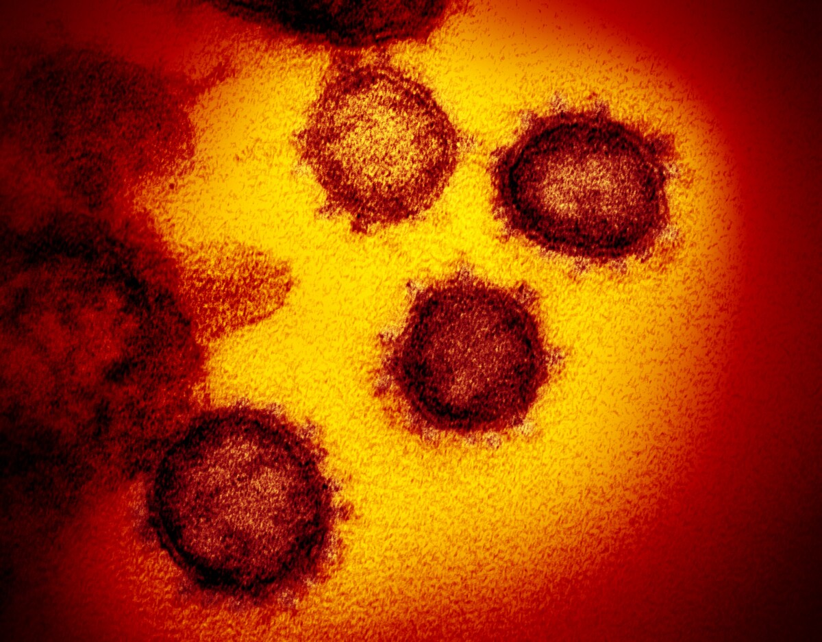 This transmission electron microscope image shows SARS-CoV-2 – also known as 2019-nCoV – the virus that causes COVID-19