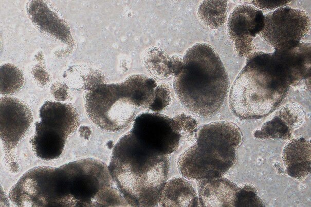 Blood progenitor cells