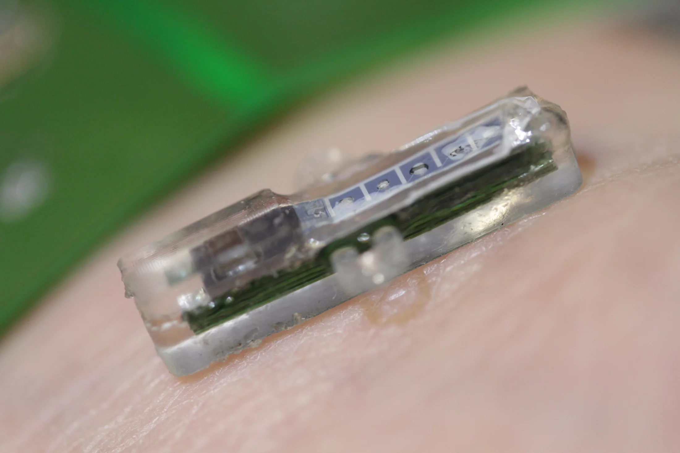 This prototype implant measures about 14 mm and comprises five sensors, a coil for wireless power as well a miniaturized electronics for radio communication (Photo: EPFL)