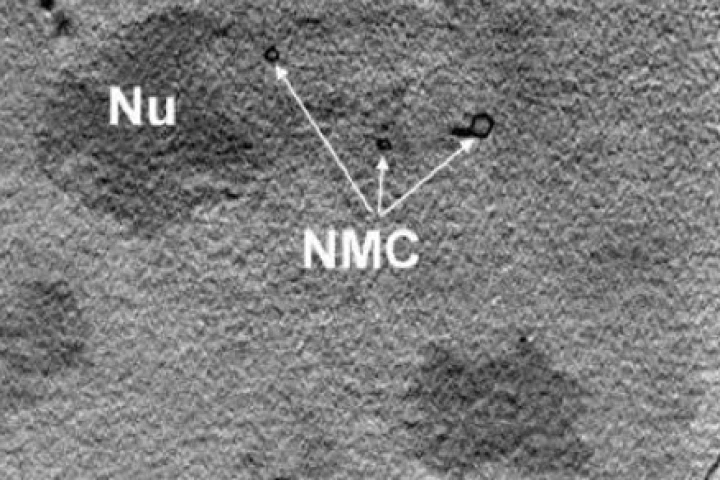 An image of the nucleus of a mouse adenocarcinoma cell showing the nucleolus and the membrane channels, taken via X-ray nanotomography (Photo: HZB)