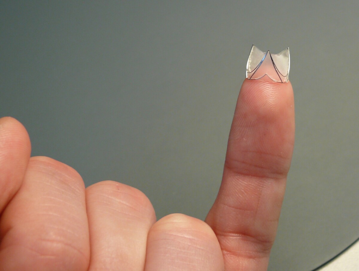 Artificial vein valve could replace drugs for treating common