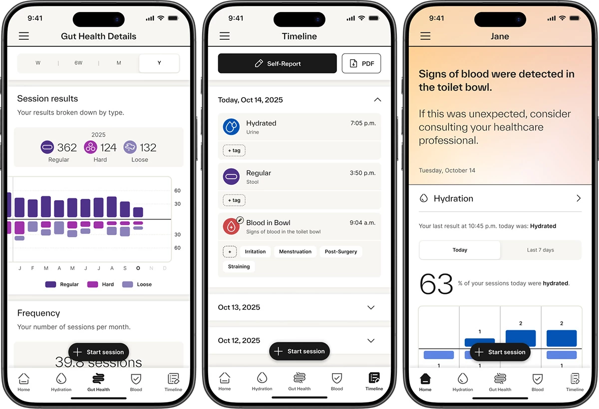 Kohler's health app gathers data from the Dekoda device and delivers insights on improving your gut health - sadly, it requires a subscription fee