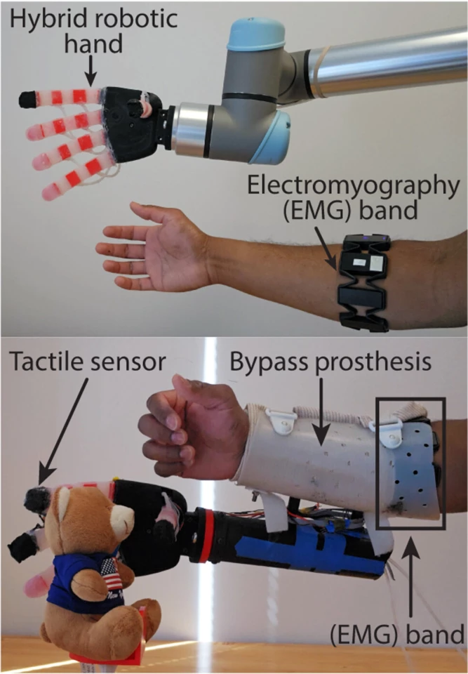 The robotic hand is controlled using EMG signals through a gesture control device (top)