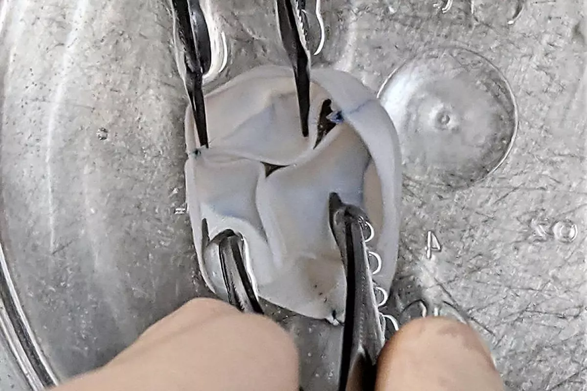 One of the bioengineered heart valves, made of three joined tubes of material