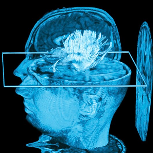 The researchers will initially target niche markets such as medical professionals for their Dualplex Display