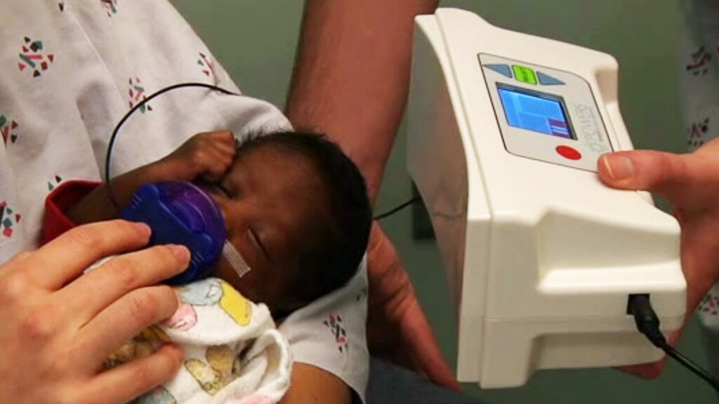 Pacifier Activated Lullaby device uses music to teach premature babies