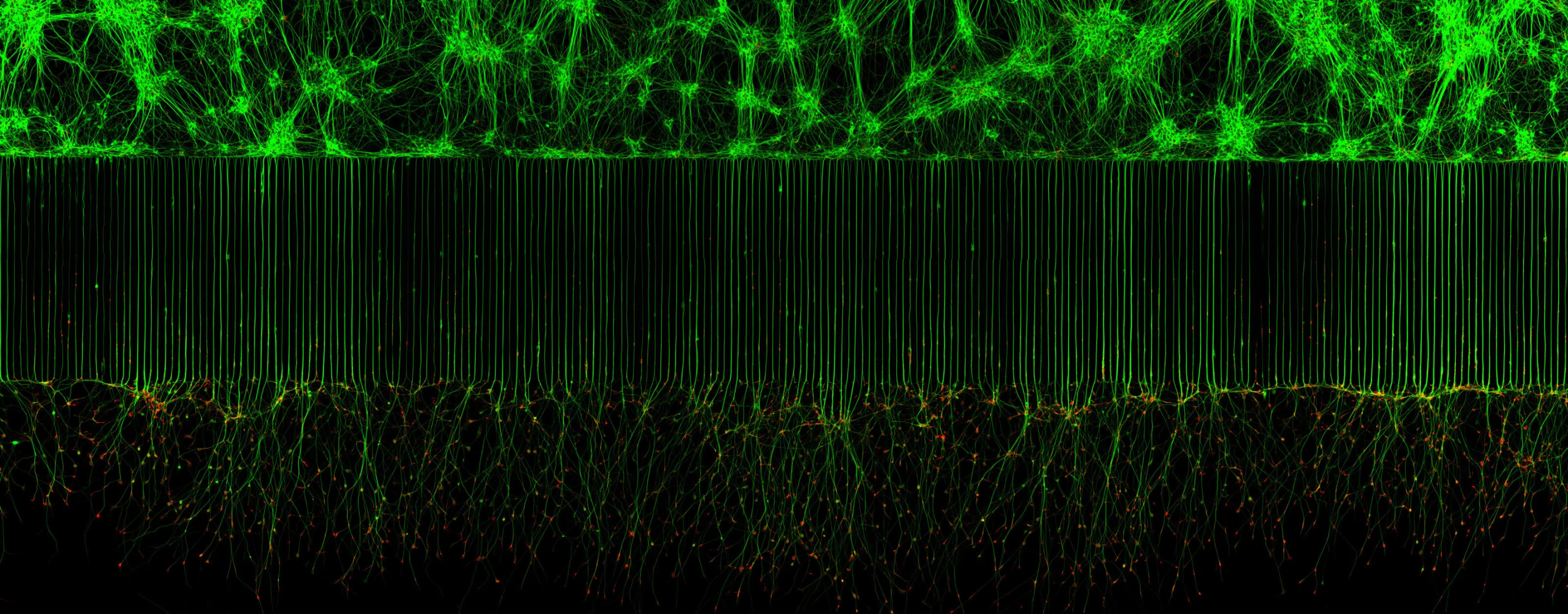 10th place. Motor neurons grown in microfluidic device for separation of cell bodies (top) and axons (bottom). Green - microtubules; Red - growth cones (actin).