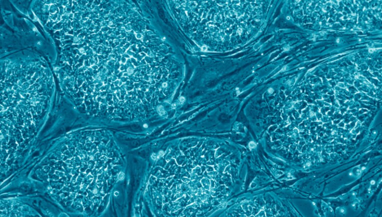 Human adult stem cells (Image: Public Library of Science)