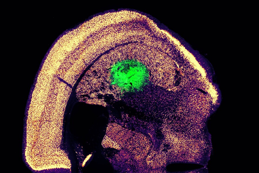 Mouse motor neurons (green) grown directly from skin cells were able to integrate with others in the animal's brain after transplantation