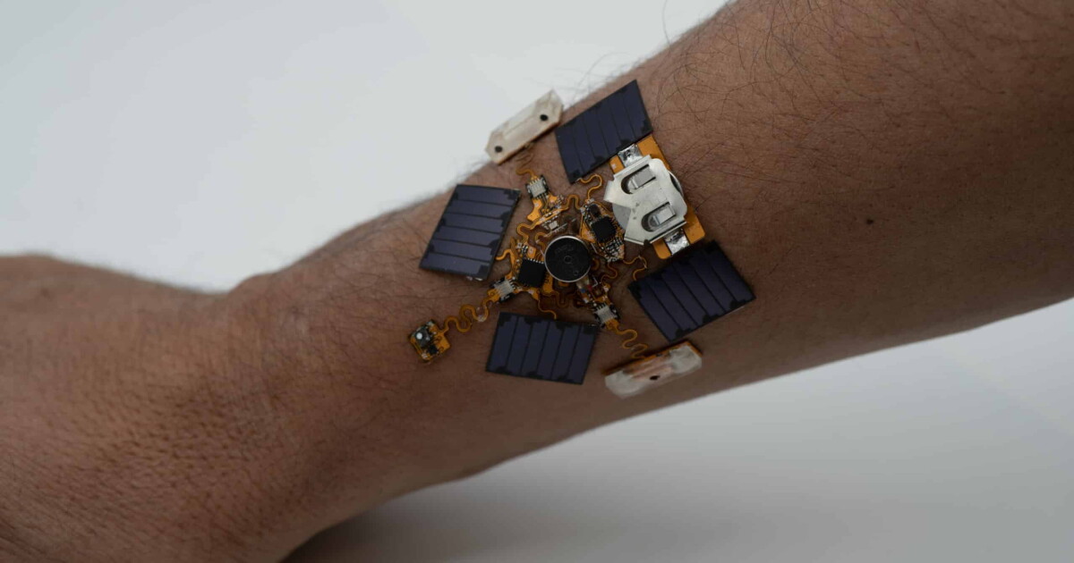A small rectangular patch on a person's arm with visible sensor modules and a textured surface.