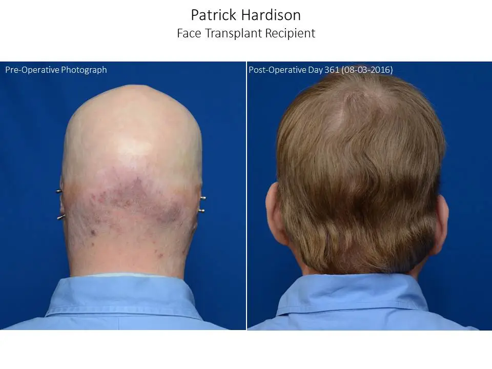 The back of Hardison's head